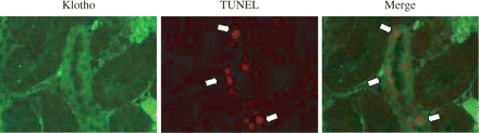 Klotho and TUNEL double staining of renal tubule. Representative immunohistochemical evaluation of klotho expression and apoptotic cells at day 3. TUNEL-positive cells are co-stained with klotho. Arrow: TUNEL-positive cells.