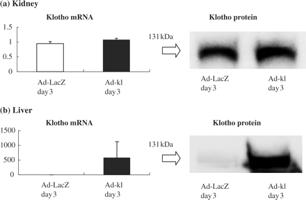 Klotho expression after gene transfer with the adenovirus. (a) Klotho mRNA and protein expressions in the kidney. Renal klotho mRNA expression in the ad-kl groups was at the same level as that of the ad-LacZ groups. There were no significant differences in protein expression between the ad-kl and ad-LacZ treated groups, as shown by the representative blotting. (b) Klotho mRNA and protein expression in the liver. In the ad-kl groups, hepatic klotho gene expression was significantly increased, by more than 500-fold as compared with the ad-LacZ groups. Remarkable expression of the klotho protein was observed in the ad-kl groups as compared with the ad-LacZ treated groups, as shown by the representative blotting.