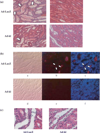 Histological changes after ad-kl treatment. (a) Representative HE staining of renal tubular cells at postoperative day 3 (×100). Tubular damage in the kidney was attenuated in the ad-kl IRI group as compared with the ad-LacZ IRI group. Arrow; cast formation and tubule dilatation. a, b; Ad-LacZ, c, d; Ad-kl, a, c; IRI, b, d; sham. (b) Representative TUNEL and DAPI staining of renal tubular cells at postoperative day 3. In contrast to the ad-LacZ IRI group, few TUNEL positive cells were observed in the kidney in the ad-kl IRI group. Arrow; apoptotic cells. a–c; Ad-LacZ IRI, d–f; Ad-kl IRI, a, d; phase, b, e; TUNEL, c, f; TUNEL+DAPI (merge). (c) Representative HE staining of renal tubular cells at postoperative day 3 (×400). In contrast to the ad-LacZ IRI group, few apoptosis cells were observed in the kidney in the ad-kl IRI group. Arrow; apoptotic cells.