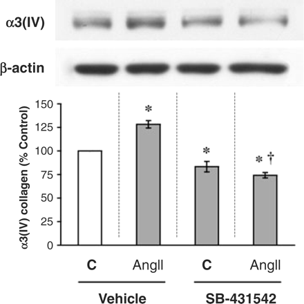 TGF-β signalling mediates the effect of AngII to stimulate α3(IV) collagen. AngII at 10−8 M was added to cultured podocytes for 8 h, with or without treatment with 1 μM SB-431542, a TGF-β signalling inhibitor. AngII stimulated α3(IV) collagen production by ∼30%, but this was prevented by concurrent treatment with SB-431542. In addition, SB-431542 lowered the baseline production of α3(IV) collagen in the absence of AngII. *P<0.05 vs control and †P<0.05 vs AngII in five independent experiments.