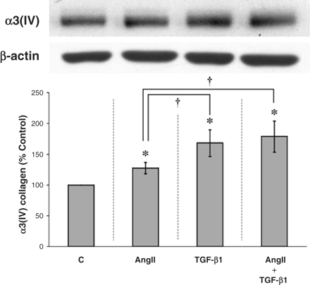 Combination treatment with AngII and TGF-β1 is more effective than AngII alone but not more effective than TGF-B1 alone. Cultured mouse podocytes were treated with 10−8 M AngII to upregulate the expression of the TGF-β type II receptor; then a submaximal dose (0.5 ng/ml) of TGF-β1 was added for the last 4 h of the experiment. Both AngII alone and TGF-β1 alone significantly increased the production of α3(IV) collagen, with TGF-β1 having the significantly greater effect. In comparison, the combination of AngII and TGF-β1 exerted a larger effect on α3(IV) collagen than AngII alone but not greater than TGF-β1 alone. *P<0.05 vs control and †P<0.05 vs AngII alone in five independent experiments.