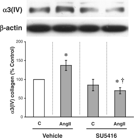AngII-induced α3(IV) collagen production is also mediated by VEGF signalling. Cultured podocytes were exposed to 10−6 M AngII for 52 h, with or without treatment with 5 μM SU5416, a VEGF signalling inhibitor. AngII stimulated α3(IV) collagen production by 37%, but this was prevented by concurrent treatment with SU5416. *P<0.05 vs control and †P<0.05 vs AngII in five independent experiments.