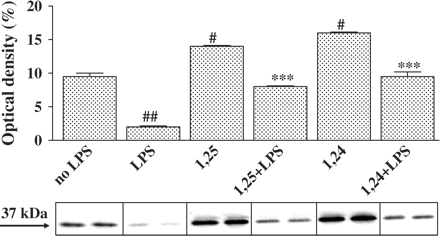 Treatment of P388D1 cells with 1,25(OH)2D3 or 1,24(OH)2D2 increases cytosolic IκBα levels. Cells were incubated for 16 h with 1,25(OH)2D3 or 1,24(OH)2D2 (10−7 M) and then stimulated with LPS (1 µg/ml) for an additional 0.5 h. Cytosol extract was prepared and IκBα levels were analysed by western blot analysis, using an anti-IκBα antibody. The results are expressed as mean±SE and represent three experiments performed in duplicate #P<0.05 or ##P<0.01 vs no LPS, ***P<0.001 vs LPS alone.
