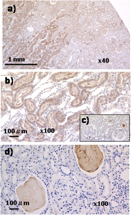 Localization of L-PGDS antigenicity in the kidney. We localized the L-PGDS antigenicity in the kidney of OLETF rats aged 48 weeks using immunoenzyme staining as described in the text. The signals were detected in the proximal tubules in the deep cortex and the outer medulla, as shown in micrograph (a). In contrast, the signals were not found in the glomeruli per se. It was noted that the signals were not found in the thin-limb of Henle's loop in the outer medulla, as shown in micrograph (b). The signals in the tubules were blocked by pretreatment of amounts of L-PGDS prior to the staining, suggesting that the expression of L-PGDS antigenicity was a specific finding [micrograph (c)]. The signals were also detected in urine casts, suggesting the presence of the antigenicity in urine per se [micrograph (d)].