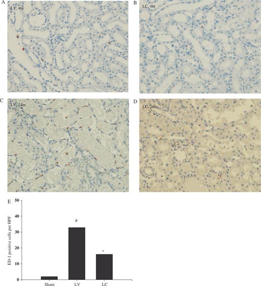  Effect of monocyte–macrophage depletion on ED-1 cell infiltration in ischaemic ARF in rats. Rats were intravenously injected with either LV or LC. At 24 h later, rat kidneys were subjected to 40 min bilateral ischaemia and sacrificed. Immunohistochemical detection of macrophages was performed with anti ED-1 antibody. ( A ) and ( C ) LV, ( B ) and ( D ) LC. ( A ) and ( B ) 4 h, ( C ) and ( D ) 24 h (ED-1 staining, ×200). ( E ) Number of ED-1-positive cells at 24 h. #P <0.05 compared with sham, * P <0.05 compared with LV, n = 5 animals per group. 