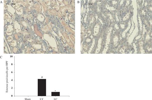  Effect of monocyte–macrophage depletion on esterase-positive leukocyte infiltration in ischaemic ARF in rats. Rats were intravenously injected with either LV or LC. At 24 h later, rat kidneys were subjected to 40 min bilateral ischaemia and sacrificed. ( A ) LV and ( B ) LC (naphthol AS-D chloracetate esterase staining, 24 h, ×200) ( C ) Number of esterase-positive cells at 24 h. #P <0.05 compared with sham, * P <0.05 compared with LV, n = 5 animals per group. 