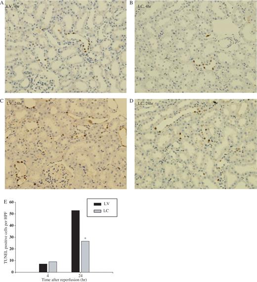  Effect of monocyte–macrophage depletion on apoptosis in ischaemic ARF in rats. Rats were intravenously injected with either LV or LC. At 24 h later, rat kidneys were subjected to 40 min of ischaemia or sham operation and sacrificed. Apoptosis was detected by TUNEL methods at 4 and 24 h after reperfusion. ( A ) and ( C ) LV, ( B ) and ( D ) LC. ( A ) and ( B ) 4 h, ( C ) and ( D ) 24 h, ×200. ( E ) Number of TUNEL-positive cells. * P <0.05 compared with LV, n = 5 animals per group. 