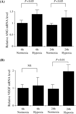 (A) Relative ANG mRNA expression in normoxic or hypoxic conditions after 6 and 24 h incubation. The average amounts of ANG mRNA at 6 h in normoxic conditions was set to 1.0. Relative ANG mRNA expression in hypoxic conditions was significantly increased both at 6 and 24 h (P<0.05) compared with the relative ANG mRNA expression in normoxic conditions at the same time points. Values are means±SD for six wells. (B) Relative VEGF mRNA expression in normoxic or hypoxic conditions for 6 and 24 h incubation. The average amount of VEGF mRNA at 6 h in normoxic conditions was set to 1.0. Relative VEGF mRNA expression in hypoxic conditions was not changed at 6 h, while it was significantly increased at 24 h (P<0.01) compared with the VEGF mRNA expression in normoxic conditions. Values are means±SD for six wells.