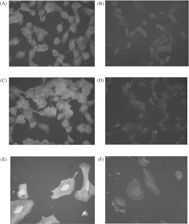 The enhancement of ANG staining was observed in the cytoplasm of PTEC exposed to (A) hypoxia in comparison with (B) normoxia. The enhancement of VEGF staining was observed in the cytoplasm of PTEC exposed to (C) hypoxia in comparison with (D) normoxia. Hypoxia enhanced hypoxia inducible factor-1α (HIF-1α) expression in the (E) cell nuclei compared with (F) normoxia. No immunoreactivity was obtained in the absence of primary antibody. (A–D): original magnification 200×. (E, F): original magnification 400×.