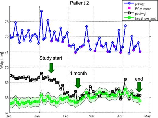 extracorporeal dialysis techniques and adequacy nephrology