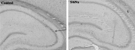 Immunohistochemical staining (anti-BDNF ab101752; 1:1000; Abcam, Cambridge, UK) of hippocampal BDNF in a control and 5/6 nephrectomized (5/6 Nx) rat; magnification: ×40. The arrow depicts positive BDNF immunoreactivity.