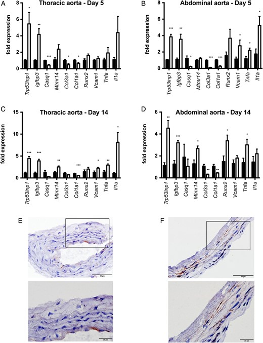 Media calcification is associated with an inflammatory and osteoblastic vascular smooth muscle cell phenotype in the abdominal aorta. DBA/2 mice were fed with high-phosphate diet (white bars) or standard chow (black bars) for 5 (A and B) or 14 days (C and D), respectively (n = 4 in each group). Quantitative PCR analyses of thoracic (A and C) and abdominal aorta (B and D) revealed a repression of the contractile and synthetic VSMC phenotype and a parallel induction of an inflammatory and osteoblastic VSMC phenotype that was more pronounced in the abdominal aorta. The Vcam1 expression in the abdominal aorta (B) was also seen in immunohistochemistry experiments, where there was a positive signal in the Tunica media (F), while Vcam1 expression in the thoracic aorta was restricted to the endothelium (E). The scale bar measures 50 µm (top row) and 20 µm (bottom row).