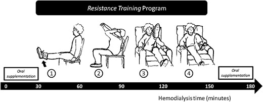 Schematic diagram of the study design. In the first hour, patients received half of the oral nutritional supplementation (ONS), during the second hour they performed four different resistance exercises and in the last hour they received the other half of the ONS.