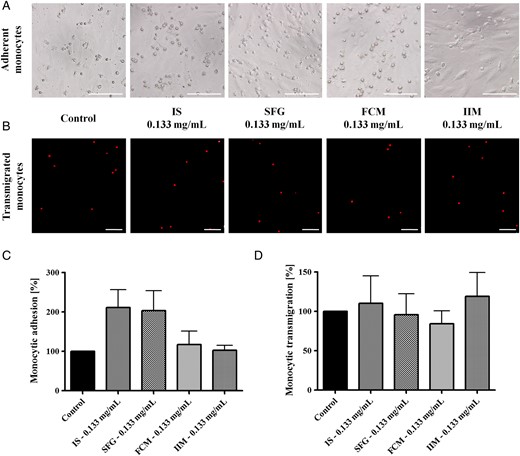 Monocytic adhesion on activated HUVECs and transmigration through 8 µM cell culture inserts (after CD45 labelling and in the presence of 50 ng/mL MCP-1) after stimulation with 0.133 mg/mL IS, SFG, FCM or IIM. Blood was collected from control subjects and evaluated by phase contrast microscopy (adhesion) and by fluorescence microscopy (transmigration). Numerical analyses were evaluated in 10 microscopic fields per approach. Representative examples of (A) monocytic adhesion and (B) transmigration; bar scales 100 µm for all images. Mean ± SEM of four independent experiments for (C) adhesion and (D) transmigration; controls (in the absence of iron) are defined as 100%. Statistical analysis was performed using ANOVA followed by Dunnett's multiple comparison test as post hoc test.
