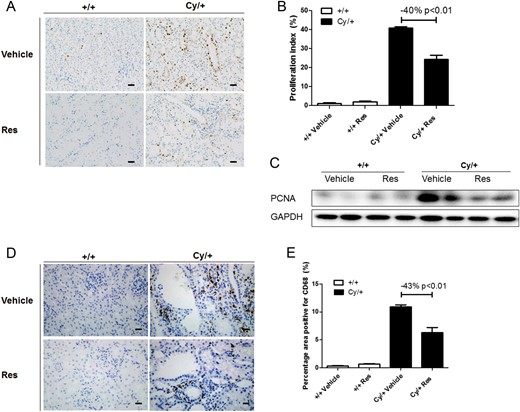 Effect of resveratrol (Res) on cell proliferation and macrophage infiltration in cystic kidneys. (A) Proliferation marker PCNA was stained in 9-week-old +/+ and Cy/+ kidneys. Scale bar = 50 µm. (B) Quantification of PCNA staining. (C) Western blot of PCNA for 9-week-old +/+ and Cy/+ rat kidneys. (D) Macrophage marker CD68 was stained in 9-week-old +/+ and Cy/+ kidneys. Scale bar = 20 µm. (E) Quantification of CD68 staining. Blots are representative of three independent experiments.