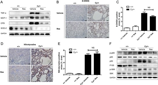 Pro-inflammatory factors, anti-oxidant enzyme and cell signaling pathways in resveratrol (Res)- or vehicle-treated cystic kidneys. (A) TNF-α, MCP-1, CFB and SOD2 were analyzed by western blot in 9-week-old +/+ and Cy/+ kidneys. (B–E) Immunohistochemical staining for oxidative stress markers 8-OHdG and nitrotyrosine in the tubulointerstitial area. Computer-assisted morphometry was used to quantify changes of 8-OHdG and nitrotyrosine in each group. Scale bar = 50 µm. (F) NF-κB pathway (p-p65, p65, p105 and p50) and mTOR pathway (p-S6K and total S6K) were analyzed by western blot in 9-week-old +/+ and Cy/+ kidneys. Blots are representative of three independent experiments.