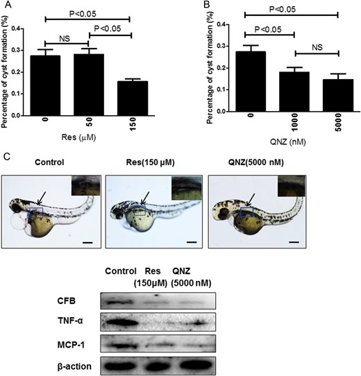 Suppression of Pkd2 morphants by resveratrol (Res) and QNZ. (A) Cyst formation was analyzed in Pkd2 morphants on Day 3 post-fertilization by treatment of resveratrol at 50 or 150 µM or by QNZ (B) at 1 or 5 µM (1000 or 5000 nM) from the shield stage. The average percentage of embryos with kidney cysts from three independent experiments is shown. Twenty-five embryos were examined in each experiment. (C) Embryos treated with 150 µM resveratrol or 5 µM (5000 nM) QNZ. The arrows point to the cyst. Insets show kidney cyst in control group, and lack of cyst in resveratrol- or QNZ-treated groups. Scale bar = 200 µm. The expression of CFB, TNF-α and MCP-1 in zebrafish were analyzed by western blot. Blots are representative of three independent experiments.