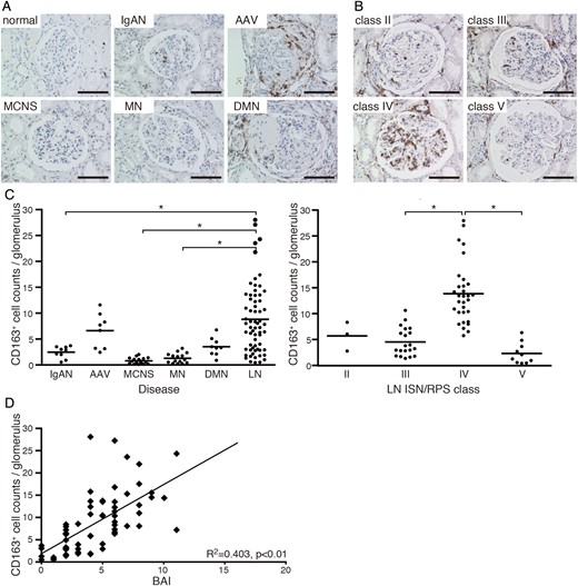 CD163 expression in patients with various kidney diseases and LN. (A) Microscopic observation of CD163+ macrophages (brown) in glomeruli of normal, IgAN, AAV, MCNS, MN and DMN kidneys. Bar: 100 µm. (B) Light microscopic analysis of LN classified according to ISN/RPS criteria. Bar: 100 µm. (C) Quantitative analysis of CD163+ cell numbers in glomeruli from patients with various kidney diseases (IgAN, n = 9; AAV, n = 8; MCNS, n = 17; MN, n = 15; DMN, n = 9; LN, n = 64; left) and LN (class II, n = 3; III, n = 20; IV, n = 31; V, n = 10; right). Each patient is represented by a dot and the mean value of each group is shown as a horizontal bar. *P < 0.05. (D) Correlation between glomerular CD163+ cell numbers from LN patients and BAI; each dot represents a value from a single patient. Coefficients of determination (R2) and P-values are shown.