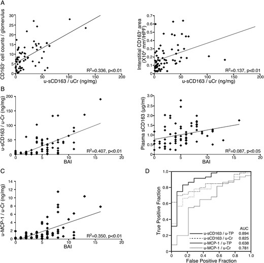Association between sCD163 and histological LN subtype. (A) u-sCD163 levels are more highly correlated with CD163+ macrophage number in glomeruli (left) than in the interstitium (right). (B) The sCD163 level in urine (left) but not plasma (right) was highly correlated with BAI. (C) Correlation between urinary MCP-1 and BAI; each dot represents a value from an individual patient. Coefficients of determination (R2) and P-values are shown. (D) ROC curves of urinary sCD163 and MCP-1 (u-sCD163 and u-MCP-1, respectively) were generated to predict ISN/RPS class III and IV subpopulations. Values were corrected by urinary Cr or TP (u-Cr and u-TP, respectively) in LN patients, along with the corresponding AUCs.