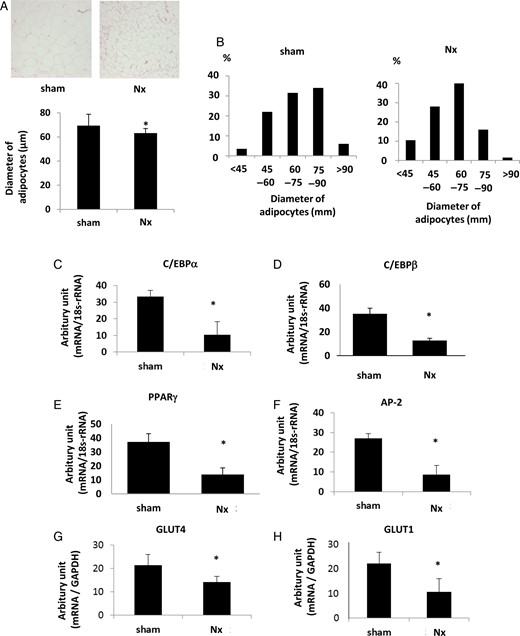The phenotype changes in adipose tissues in Nx rats. (A) The results of hematoxylin and eosin staining of the adipose tissue in Nx rats and sham-operated rats are shown in the upper panel. The bar graph in the lower panel represents the averages of diameters of adipocytes in Nx rats and sham-operated rats. (B) The population of diameters of adipocytes in the adipose tissues of Nx rats and sham-operated rats. The mRNA expression levels of the adipocyte differentiation markers, CEBPα (C), CEBPβ (D), PPARγ (E) and AP-2 (F), were measured by real-time PCR. The mRNA expressions of glucose transporter, GLUT4 (G) and GLUT1 (H), were also examined. *P < 0.05 versus sham-operated rats, n = 6. Data are presented as mean ± SEM.
