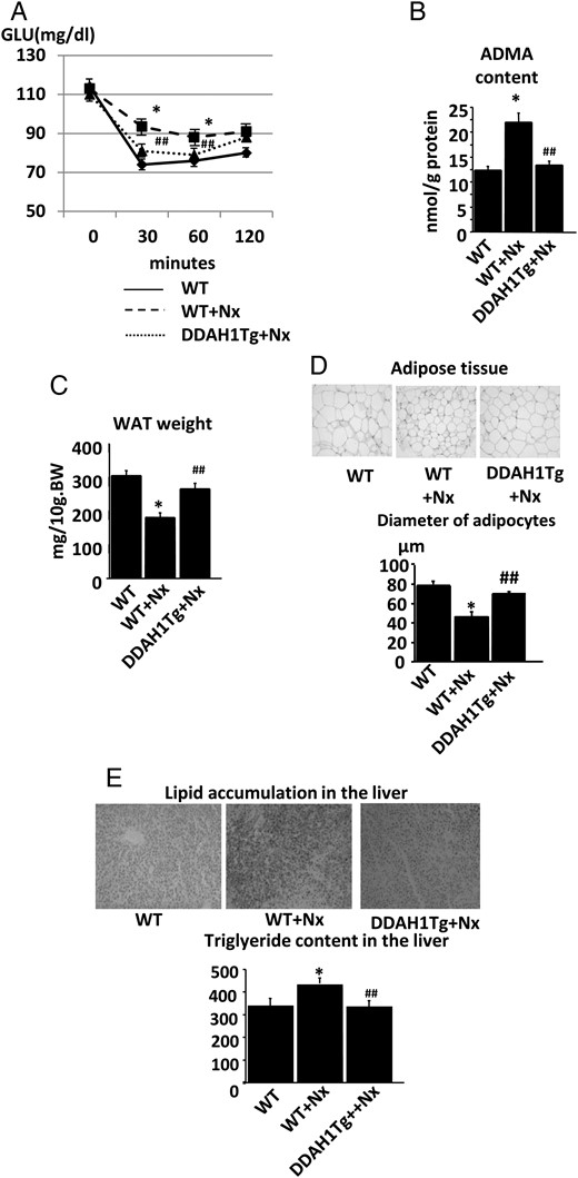 DDAH1 Tg mice reversed the lipodystrophic-like phenotype in renal insufficiency. (A) The results of the insulin tolerance test in DDAH1 Tg mice. The IR in WT littermates after Nx was ameliorated in DDAH1 Tg mice. (B) The ADMA content in the adipose tissue of DDAH1 Tg mice. The accumulation of ADMA in WT littermates after Nx was ameliorated in DDAH1 Tg mice. (C) The weight of white adipose tissue (WAT) in DDAH1 Tg mice. The adipose tissue atrophy in WT littermates after Nx was ameliorated in DDAH1 Tg mice. (D) The size of adipocytes in DDAH1 Tg mice. The decrease in adipocyte diameters in WT littermates after Nx was reversed in DDAH1 Tg mice. (E) The lipid accumulation in the liver in DDAH1 Tg mice. The ectopic lipid deposition in WT littermates after Nx was ameliorated in DDAH1 Tg mice. *P < 0.05 versus WT littermate without Nx, ##P < 0.01 versus WT littermate with Nx, n = 6. Data are presented as mean ± SEM.