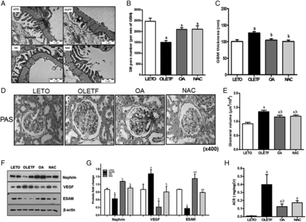 OA and NAC repaired damaged renal structures and urinary ACR (mg/mg Cr). Ultrastructural measurements by TEM were performed on the glomerular filtration barrier at ×30 000 magnification. The OLETF group experienced podocyte effacement and consequent reduced open slit pore density, while OA or NAC administration improved open slit pore density (A, B). Abnormally increased GBM thickness in the OLETF group was significantly reduced in the OA- or NAC-treated groups (A, C). At 45 weeks of age, renal glomeruli were stained with periodic acid-Schiff stain. Increased glomerular volume of the OLETF group was significantly decreased by OA or NAC administration (D, E). Decreased nephrin and ESAM levels in the OLETF group were significantly increased by OA or NAC administration. Moreover, increased VEGF was decreased in the OA- or NAC-treated groups (F, G). These changes reduced the increased urinary ACR in the OLETF group (H). LETO, control group; OLETF, diabetic control group; OA, oleanolic acid-treated diabetic group; NAC, N-acetylcysteine-treated diabetic group; ESAM, endothelial selective adhesion molecules. Data are expressed as mean ± SEM. aP < 0.05 versus LETO, bP < 0.05 versus OLETF.