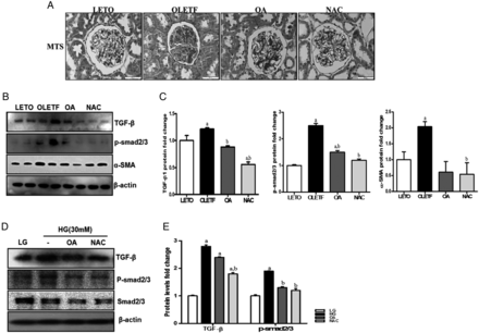 Antifibrosis effect of OA and NAC in OLETF rats. At 45 weeks of age, renal glomeruli were stained with Masson's trichrome stain (MTS) (A). In the OLETF group, increased glomerular fibrosis was decreased in the OA- or NAC-treated groups. In addition, the TGF-β/p-smad2/3 signal pathway, which induces tissue fibrosis, was increased in the OLETF group compared with the LETO group; increased TGF-β/p-smad2/3 levels were decreased by OA or NAC administration (B, C). HG also increased the TGF-β/p-smad signal pathway, and OA or NAC treatment reduced TGF-β/p-smad2/3 expression (D, E) in MES-13. LETO, control group; OLETF, diabetic control group; OA, oleanolic acid-treated diabetic group; NAC, N-acetylcysteine-treated diabetic group; LG, low-glucose (5.5 mM) media; HG, high-glucose (30 mM) media; MES-13, mouse mesangial cells. Data are expressed as mean ± SEM. aP < 0.05 versus LETO, bP < 0.05 versus OLETF.