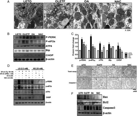 OA and NAC reduced ER stress and apoptosis. In the OLETF group, ER and mitochondrial structures were damaged by diabetes (A). ER stress markers (B, C) and cell apoptosis (E, F) were significantly increased in the OLETF group, but ER stress and apoptosis were decreased by OA or NAC administration. HG also activated ER stress markers in mesangial cells, but OA or NAC administration inhibited ER stress induction (D). LETO, control group; OLETF, diabetic control group; OA, oleanolic acid-treated diabetic group; NAC, N-acetylcysteine-treated diabetic group; LG, low-glucose (5.5 mM) media; HG, high-glucose (30 mM) media; Tg, thapsigargin; 4PBA, 4-phenylbutyrate. Data are expressed as mean ± SEM. aP < 0.05 versus LETO, bP < 0.05 versus OLETF.