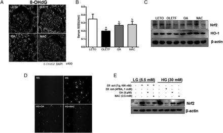 Antioxidant effect of OA and NAC. Increased 8-OHdG in the OLETF group was decreased by OA or NAC administration (A). Otherwise, serum SOD, renal Nrf2 and HO-1 levels were reduced in the OLETF group; OA or NAC restored these decreased levels (B, C). ROS was increased by HG stimulation; OA or NAC reduced ROS production (D). Moreover, Nrf2 expression was increased by Tg or HG, and 4PBA, OA or NAC treatment reduced the increased Nrf2 (E). LETO, control group; OLETF, diabetic control group; OA, oleanolic acid-treated diabetic group; NAC, N-acetylcysteine-treated diabetic group; SOD, superoxide dismutase; LG, low-glucose (5.5 mM) media; HG, high-glucose (30 mM) media; Tg, thapsigargin; 4PBA, 4-phenylbutyrate. Data are expressed as mean ± SEM. aP < 0.05 versus LETO, bP < 0.05 versus OLETF.