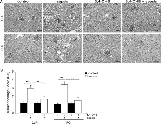 Effect of PHD suppression on renal injury in septic mice assessed by PAS. Inhibition of the PHDs was achieved by i.p. administration of 3,4-DHB 4 h prior to sepsis induction by CLP or PCI. Sepsis-related kidney damage was analysed on 5-µm paraffin kidney sections. (A) Effect of septic conditions and 3,4-DHB application on renal damage. The arrows show the tubular damage presented as vacuolization and dilation of the tubular regions in CLP and PCI septic mice. Less damage is detectable when the PHD activity was suppressed prior to sepsis. Representative images are shown. Scale bars for all images correspond to 50 µm. 3,4-DHB, ethyl-3,4-dihydroxybenzoate; CLP sepsis, caecal ligation and punction-induced sepsis; PCI sepsis, PCI-induced sepsis. (B) Estimation of the tubular damage by scoring system. 0, no damage; 5, extreme vacuolization and dilation of the tubuli. **P < 0.01, ***P < 0.001.