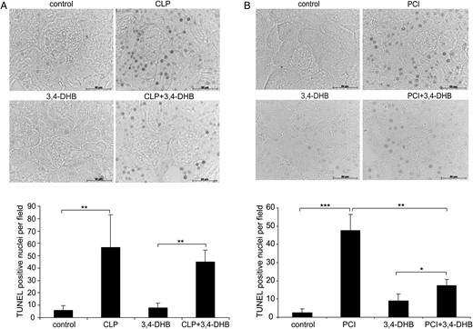 Effect of PHD inhibition on sepsis and endotoxemia-induced renal apoptosis. Apoptotic events were analysed on paraffin kidney sections by TUNEL assay. The staining was analysed using an Axioplan microscope and Axiovision 4.6 software (Zeiss). Few apoptotic nuclei were detected at baseline. Mostly tubular cells underwent apoptosis under our experimental conditions. Images were taken under ×400 magnification. The number of TUNEL-positive nuclei was counted and is graphically presented for each treatment. (A) CLP induced apoptosis in kidney tissue. Septic conditions significantly increased the number of apoptotic nuclei (**P < 0.01 versus sham-operated mice), which was lower in mice that received 3,4-DHB before CLP induction. Representative images are shown. Scale bars correspond to 50 µm. n = 3 per treatment. (B) PCI-dependent apoptosis in renal tissues. Inhibition of PHDs prior to PCI sepsis significantly attenuated renal apoptosis compared with PCI treatment alone (**P < 0.01 versus PCI) (***P < 0.001, **P < 0.01, *P < 0.05). Representative images are shown. Scale bars correspond to 50 µm. n = 3 per treatment.