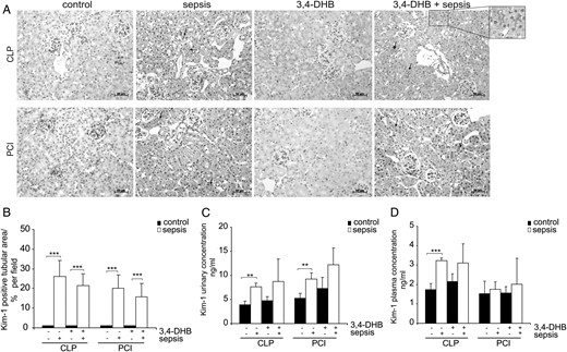 Detection of KIM-1 expression in renal tissue, urine and blood plasma. (A) Evaluation of tubular injury by immunohistological analyses of KIM-1 in kidney paraffin sections. The nuclei were counterstained with haematoxylin. The images were taken with ×200 magnification. Sham-operated or saline-treated animals showed almost undetectable KIM-1 tubular staining. PHD suppression did not influence significantly the basal or sepsis-dependent KIM-1 expression in renal tubuli. The arrows show the expression of KIM-1 in the surface of tubular epithelial cells. An enlargement of the KIM-1 tubular stain is shown in box. The nuclear KIM-1-positive stain in some of the images should be considered as non-specific staining. Representative images are shown. Scale bars correspond to 50 µm. n = 3 kidney sections per treatment. (B) Evaluation of the KIM-1-positive tubular area per field. The KIM-1-positive tubular area was analysed by ImageJ software and presented as the averaged per cent per field. At least 12 images per treatment were evaluated. ***P < 0.001. (C) Measurement of KIM-1 protein concentrations in 24-h collected urines by ELISA. The concentrations are calculated and expressed in absolute terms (ng/mL). Septic conditions increased the urinary KIM-1 levels and HIF presepsis activation slightly elevated basal as well as sepsis-dependent KIM-1 urinary concentrations. **P < 0.01, n = 4 per experimental settings. (D) Detection of KIM-1 plasma concentrations by ELISA. CLP sepsis induced KIM-1 plasma expression, but PHD inhibition did not impact KIM-1 plasma levels. PCI sepsis did not affect KIM-1 plasma levels compared with the corresponding sham-operated or saline-treated mice. ***P < 0.001, n = 4 per treatment.