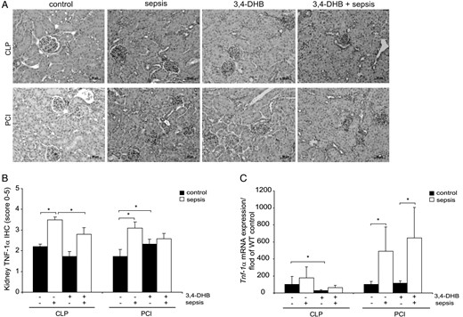 TNF-α protein and gene expression in renal tissue. (A) Immunohistological detection of renal TNF-α protein expression. The nuclei were counterstained with haematoxylin. Representative images are shown. Scale bars correspond to 50 µm. n = 9–12 kidney sections per treatment. (B) Estimation of TNF-α protein expression in kidney by scoring. The graph represents the evaluations of each treatment (CLP or PCI) separately without a comparison between the groups. *P < 0.05, n = 9–12. (C) Relative expression of Tnf-α mRNA studied by quantitative real-time PCR. The data are presented in fold relative to the corresponding wild-type saline control or sham-operated control mice. 3,4-DHB inhibited basal Tnf-α renal expression in the CLP septic group and also decreased, but not significantly, sepsis-dependent Tnf-α expression. In PCI septic animals, 3,4-DHB leads to a significant increase of Tnf-α mRNA expression post-sepsis. The quantifications shown in the graph are presented for each treatment (CLP or PCI) separately without a comparison between the groups. *P < 0.05, n = 9–12 per treatment.