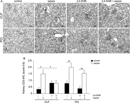 Determination of renal T-cell infiltration. Presence of T cells in the renal tissue was evaluated by CD3 immunohistochemistry. (A) Immunohistological detection of renal CD3-positive T cells. The nuclei were counterstained with haematoxylin. Representative images are shown. Scale bars correspond to 50 µm. n = 9–12 kidney sections per treatment. (B) Quantification of T-cell infiltration in controls and septic mice in the presence or absence of 3,4-DHB by the scoring system. The graph represents the quantification of each treatment (CLP or PCI) separately without a comparison between the groups. T-cell infiltration was elevated in both sepsis models (*P < 0.05 CLP versus sham-operated mice; **P < 0.01 PCI versus saline control), but while 3,4-DHB reduced the number of renal T cells in the CLP model (*P < 0.05 versus CLP alone), this effect was not seen in PCI-treated mice.