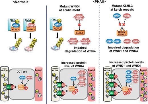 Regulation of WNK signaling by KLHL3–CUL3 complex and molecular pathogenesis of PHAII. Under normal conditions, protein levels of WNK1 and WNK4 in DCT are maintained by degradation through ubiquitination by the KLHL3–CUL3 E3 ligase complex. However, PHAII-causing mutations in the acidic domain of WNK4, and in the Kelch domains of KLHL3, interrupt binding of the KLHL3–CUL3 E3 ligase complex, resulting in impaired ubiquitination and degradation of WNK kinases. PHAII-causing CUL3 mutations lack a portion of exon 9 shown to have decreased ubiquitination and degradation of WNK kinases. Thus, PHAII-causing mutations in three different genes share a common mechanism: decreased ubiquitination and increased WNK1/WNK4 protein levels in DCT cells. Both WNK1 and WNK4 are increased in the kidneys with PHAII caused by KLHL3 and CUL3 mutations. This could lead to more severe phenotypes compared with PHAII caused by single WNK1 or WNK4 mutations. Ub, ubiquitin; DCT, distal convoluted tubule.