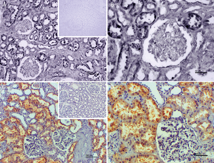 Representative images of in situ hybridization for MT2A mRNA (A and B) and immunohistochemistry with an antibody against MT1 and MT2 isoforms (C and D). MT2A on the mRNA level (dark blue/black labels in A and B) as well as MTs on the protein level (brown coloured in C and D) are located in (epithelial cells of) proximal tubuli. Glomeruli show sparse MT labelling. Inserts show negative controls. Scale bars indicate 100 µm (A and C) and 50 µm (B and D).