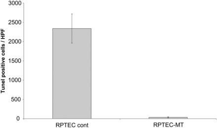 Effect of 36 h of hypoxia on RPTEC control and RPTEC MT cells assessed by TUNEL assay. RPTEC MT cells were significantly (P < 0.0001) less susceptible to hypoxia than control cells. Representative experiment of three with n= 5 for each is shown.