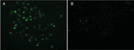 RPTEC control (A) and RPTEC MT (B) cells after 36-h incubation under hypoxic conditions stained by TUNEL assay.