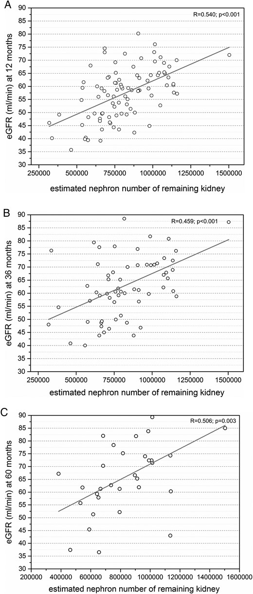 (A) Strong positive correlation between eGFR and estimated nephron number of the remaining kidney at +12 months after nephrectomy (n = 91). (B) Strong positive correlation between eGFR and donor birth weight at +36 months after nephrectomy (n = 63). (C) Strong positive correlation between eGFR and donor birth weight at +60 months after nephrectomy (n = 32).