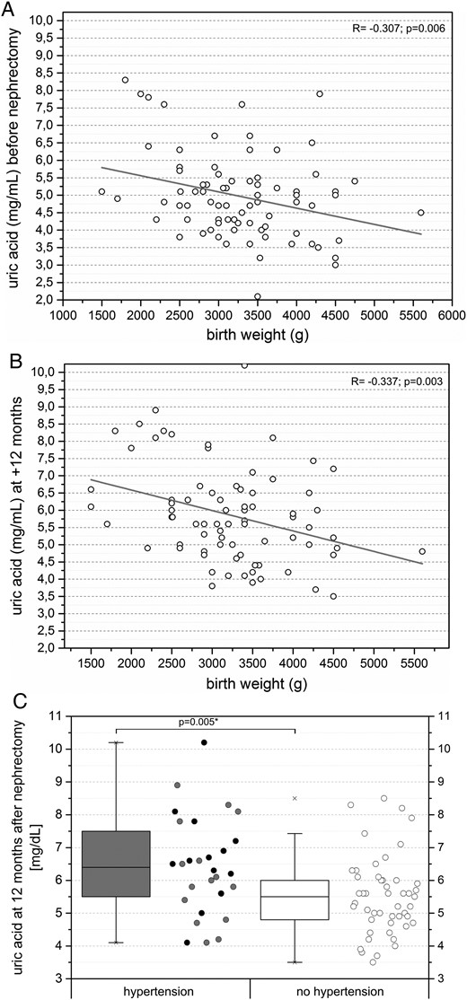 (A) Moderate negative correlation between donor serum uric acid levels and donor birth weight before nephrectomy (n = 80). (B) Moderate negative correlation between donor serum uric acid levels and donor birth weight at +12 months after nephrectomy (n = 77). (C) Significantly higher serum uric acid levels in donors with pre-existing or new-onset hypertension +12 months after nephrectomy. Black dots mark donors with pre-existing hypertension and grey dots mark donors with new-onset hypertension.