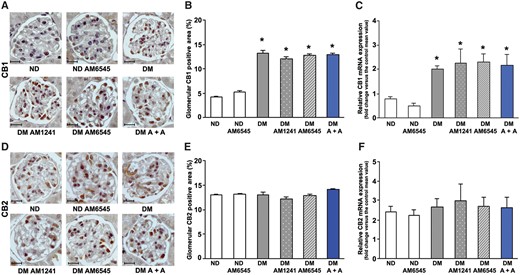 Effect of AM6545 and/or AM1241 on CB1R and CB2R expression. CB1 and CB2 mRNA and protein expression was assessed in ND mice and DM treated with AM6545, AM1241 or both (A + A) (n = 8 mice per group). Scale bar: 50 µm; representative immunohistochemistry images of CB1 (A) and CB2 (D) are shown and quantification of glomerular staining reported in the graphs (B, E). CB1 and CB2 mRNA levels were measured by real-time PCR on total RNA extracted from the renal cortex (C, F). *P < 0.05, DM groups versus ND groups.