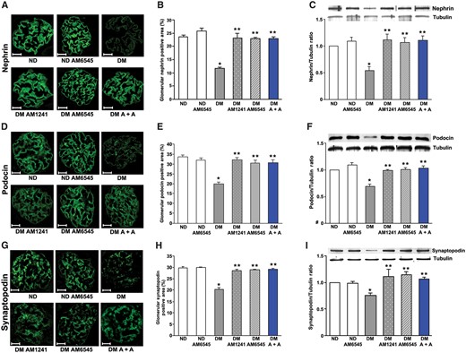 Both AM6545 and AM1241 prevented podocyte protein downregulation in diabetic mice. Nephrin, podocin and synaptopodin protein expression was assessed in ND mice and DM treated with AM6545, AM1241 or both (A + A) (n = 8 mice per group) by immunofluorescence and western blotting. Scale bar: 50 µm. Representative immunofluorescence images of nephrin (A), podocin (D) and synaptopodin (G) are shown and quantification of glomerular staining reported in the graphs (B, E, H). Representative immunoblots of nephrin (C), podocin (F) and synaptopodin (I) protein expression in total protein extracts from the renal cortex and corresponding results of densitometry analyses are shown in the graphs. Tubulin was used as an internal control. *P < 0.05, DM group versus ND groups; **P < 0.05, treated DM groups versus DM group.