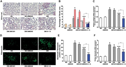 Effect of AM6545 and/or AM1241 on both collagen and fibronectin expression. Collagen and fibronectin protein and mRNA expression was assessed in ND mice and DM treated with AM6545, AM1241 or both (A + A) (n = 8 mice per group). (A) Representative images of picrosirius red staining and (B) quantitation of glomerular (first columns) and interstitial staining (second columns) are shown. Images in (D) show immunofluorescence staining for fibronectin. Scale bar: 100 µm. Quantification of fibronectin staining is reported in the graph (E). Collagen type I (C) and fibronectin (F) mRNA expression was measured by real-time PCR on total RNA extracted from the renal cortex and results reported in the graphs. *P < 0.05, DM groups versus ND controls; **P < 0.05, DM-AM6545 and DM-A + A versus DM; ***P < 0.05, DM-A + A versus DM-AM6545.