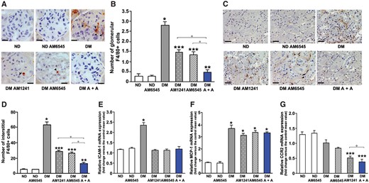 Effect of AM6545 and AM1241 on diabetes-induced inflammation. Monocyte infiltration and markers of inflammation were assessed in ND mice and DM treated with AM6545, AM1241 or both (A + A) (n = 8 mice per group). Representative images of both glomerular (A) and tubulo-interstitial (C) F4/80-positive staining are shown and quantitation reported in the graphs (B, D). Scale bar: 50 µm (A) and 100 µm (C). Total RNA was extracted from the renal cortex and mRNA levels of ICAM-1 (E), MCP-1 (F), CCR2 (G) measured by real time-PCR. *P < 0.05, DM groups versus ND controls; **P < 0.05, treated DM groups versus DM group; ***P < 0.05, DM under combined treatments versus DM under single treatment.