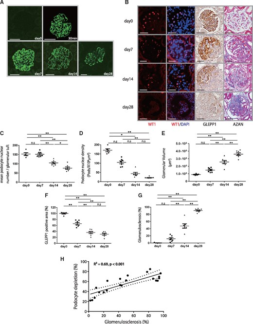 Histological and podometric analysis of disease progression in a rat model of anti-GBM nephritis. (A) Representative immunofluorescent anti-rabbit IgG staining at day 0, 30 min, days 7, 14 and 28 after NTS injection. No immunostaining was seen in the glomerulus at day 0. A strong linear immunostaining pattern was observed at 30 min, days 7, 14 and 28 after NTS injection (bar = 50 μm). (B) Representative histology for sequential kidney biopsies. From upper to lower, micrographs are from days 0, 7, 14 and 28 after NTS injection. Far-left and second-left panels show podocyte nuclei identified using WT1 and WT1/DAPI immunofluorescence staining. Second-right panel shows podocytes identified using GLEPP1/peroxidase. Far-right panel shows Azan staining (bar = 50 μm). (C) Quantification of histology using WT1-positive mean podocyte nuclear number per glomerular tuft. (D) Quantification of podocyte density. (E) Quantification of glomerular volume. (F) Percentage of glomerular tuft area that was positive for GLEPP1. (G) Percentage of glomerulosclerosis using Azan staining. (H) Relationship between percentage of GLEPP1-positive area per tuft and percentage of glomerulosclerosis using AZAN staining (n = 21, R2 = 0.69, P < 0.001). Dotted lines represent 95% confidence intervals. More than 30% podocyte depletion was a strong linear relationship between further podocyte depletion and the development of glomerulosclerosis. n = 7; ns = non-significant, *P < 0.05 and **P < 0.01, assessed using one-way ANOVA followed by the Tukey test. Part (D) was assessed using the Kruskal–Wallis test followed by the Dunn test.