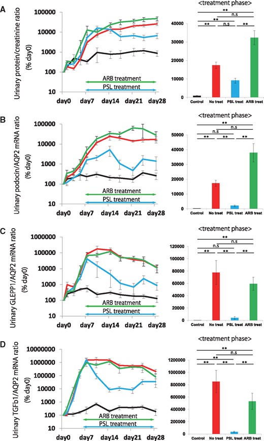 Effect on urinary podocyte and TGF-β1 mRNA following steroid or ARB treatment in a rat model of anti-GBM nephritis. (A) Time course of urinary protein:creatinine ratio and comparison in treatment phase (days 7–28). (B) Time course of urinary podocin:aquaporin 2 (AQP2) mRNA ratio and comparison in treatment phase (days 7–28). (C) Time course of urinary GLEPP1:AQP2 mRNA ratio and comparison in treatment phase (days 7 − 28). (D) Time course of urinary TGF-β1:AQP2 mRNA ratio and comparison in treatment phase (days 7–28). Steroid treatment rapidly and significantly reduced urinary podocyte mRNA in the urinary pellet for both podocyte markers tested (podocin and GLEPP1). A similar result was seen for urinary pellet TGF-β1 mRNA, where steroid treatment reduced urinary pellet TGF-β1 mRNA. In contrast, proteinuria was not significantly reduced by steroid treatment. ARB treatment did not reduce any marker tested including urinary protein:creatinine ratio, or urinary podocyte (podocin or GLEPP1) or urinary TGF-β1 mRNA excretion rates. n = 6 for the control group, n = 7 for the no treatment group, n = 6 for the steroid treatment group and n = 5 for the ARB treatment group. ns = non-significant, *P < 0.05 and **P < 0.01, assessed using the Kruskal–Wallis test followed by the Dunn test. PSL, predonisolone.