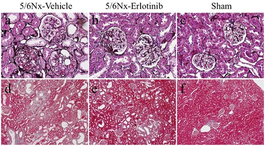 Light microscopic findings in the study groups. Representative images of kidney sections stained with (A–C) silver and (D–F) Masson trichrome in a 5/6Nx-vehicle rat (A, D), a 5/6Nx-erlotinib rat (B, E), and a Sham rat (C, F). Original magnifications, 200× (A–C) and 100× (D–F).