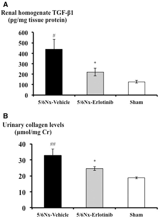 Effects of erlotinib on TGF-β1 protein synthesis and urinary collagen levels in the study groups. (A) Renal cortical homogenate TGF-β1 protein levels of each group measured by ELISA. (B) Urinary collagen levels of each group measured as described in ‘Materials and Methods’. Data are expressed as mean ± SEM. Mann–Whitney test: *P < 0.05: 5/6Nx-vehicle versus 5/6Nx-erlotinib; #P < 0.05, ##P < 0.01: 5/6Nx-vehicle versus Sham.