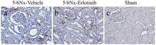 Immunohistochemical analysis of ED-1 expression in the study groups. Representative images of immunohistochemical staining for ED-1 of (A) a 5/6Nx-vehicle rat, (B) a 5/6Nx-erlotinib rat and (C) a Sham rat. Original magnification, 200×.