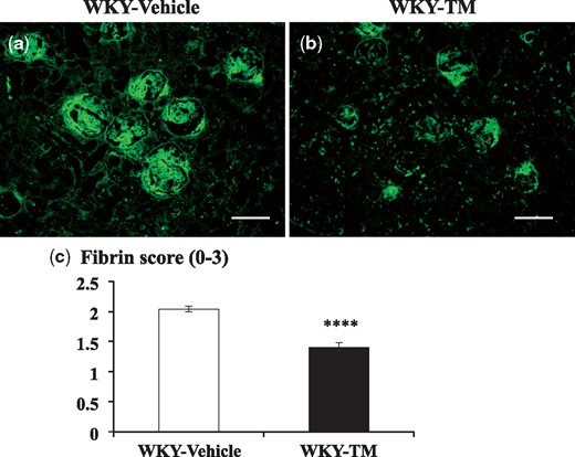 Fibrin staining by immunofluorescence microscopy in the study groups. Immunofluorescent staining for fibrin in a WKY-Vehicle rat (a) and a WKY-TM rat (b) on Day 7, and semi-quantitative assessment of fibrin deposition in each group (c) are shown. Each group contained 13 rats, and 50 glomeruli per rat were evaluated in a blinded fashion. Data are expressed as mean ± SEM. ****P < 0.0001: WKY-Vehicle versus WKY-TM. Original magnification, ×200. Scale bar, 100 μm.